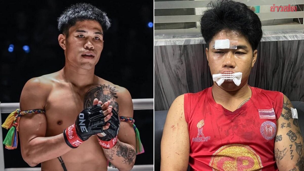 เงาพยัคฆ์ แอ๊ดสันป่าตอง - นักมวย ONE ลุมพินี ถูกชาย 2 คนรุมทำร้ายกลางเชียงใหม่