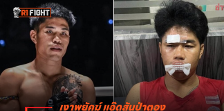 เงาพยัคฆ์ แอ๊ดสันป่าตอง – นักมวย ONE ลุมพินี ถูกชาย 2 คนรุมทำร้ายกลางเชียงใหม่